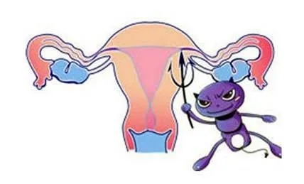 【复亚妇科】教你区分女性的7种阴道炎 !